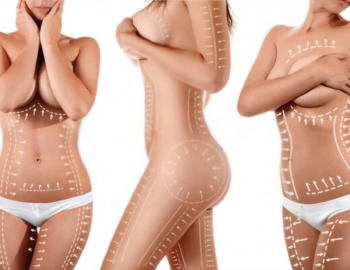 Liposuction (Yağ Aldırma)